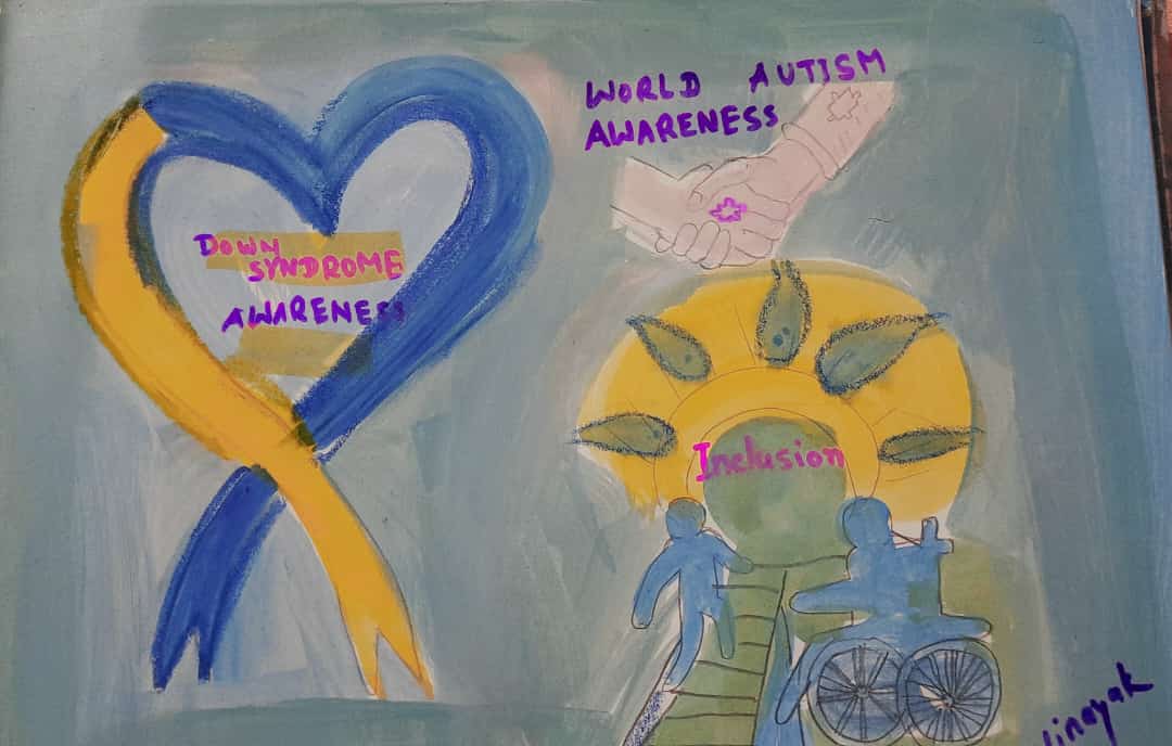 Down syndrome: an incurable disorder