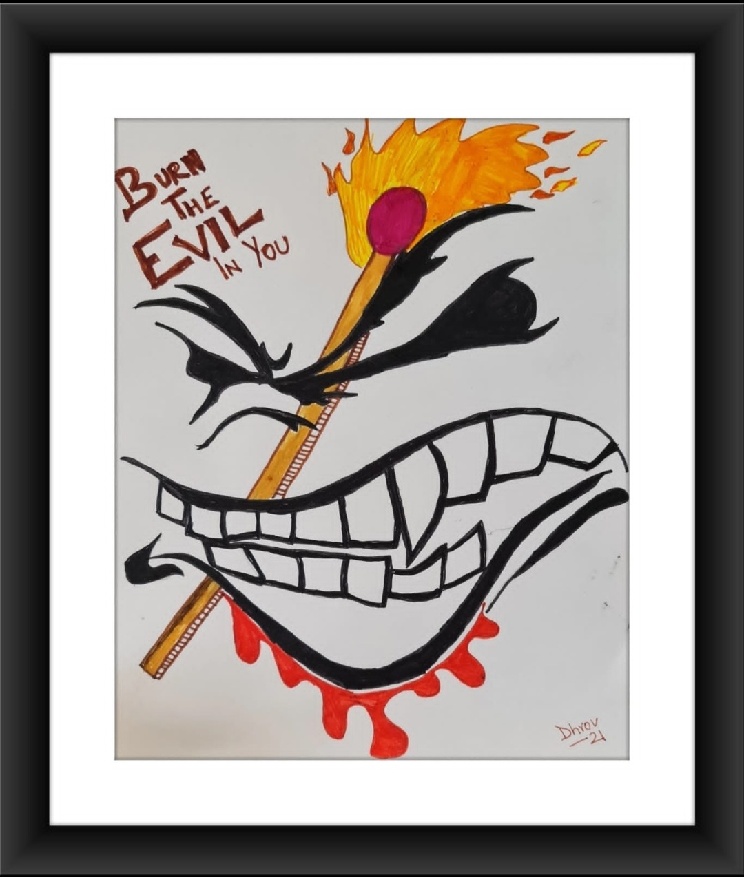 Depression in Children